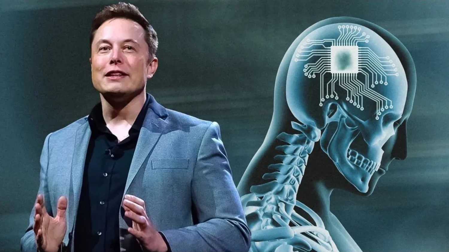 Implan Chip Otak Elon Musk Klaim Bisa Lakukan Hal Ini